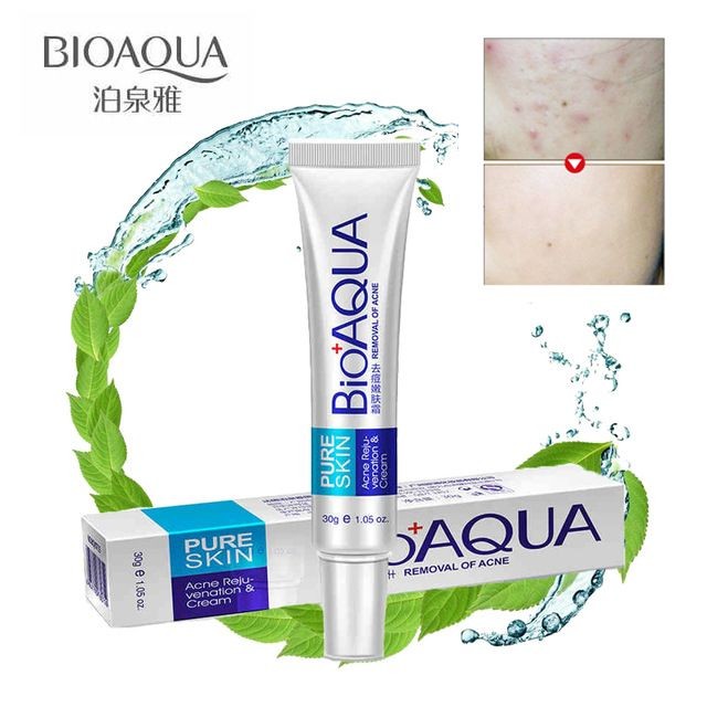 bioaqua-acne-cream-scars-removal-face-cream-onide-lk